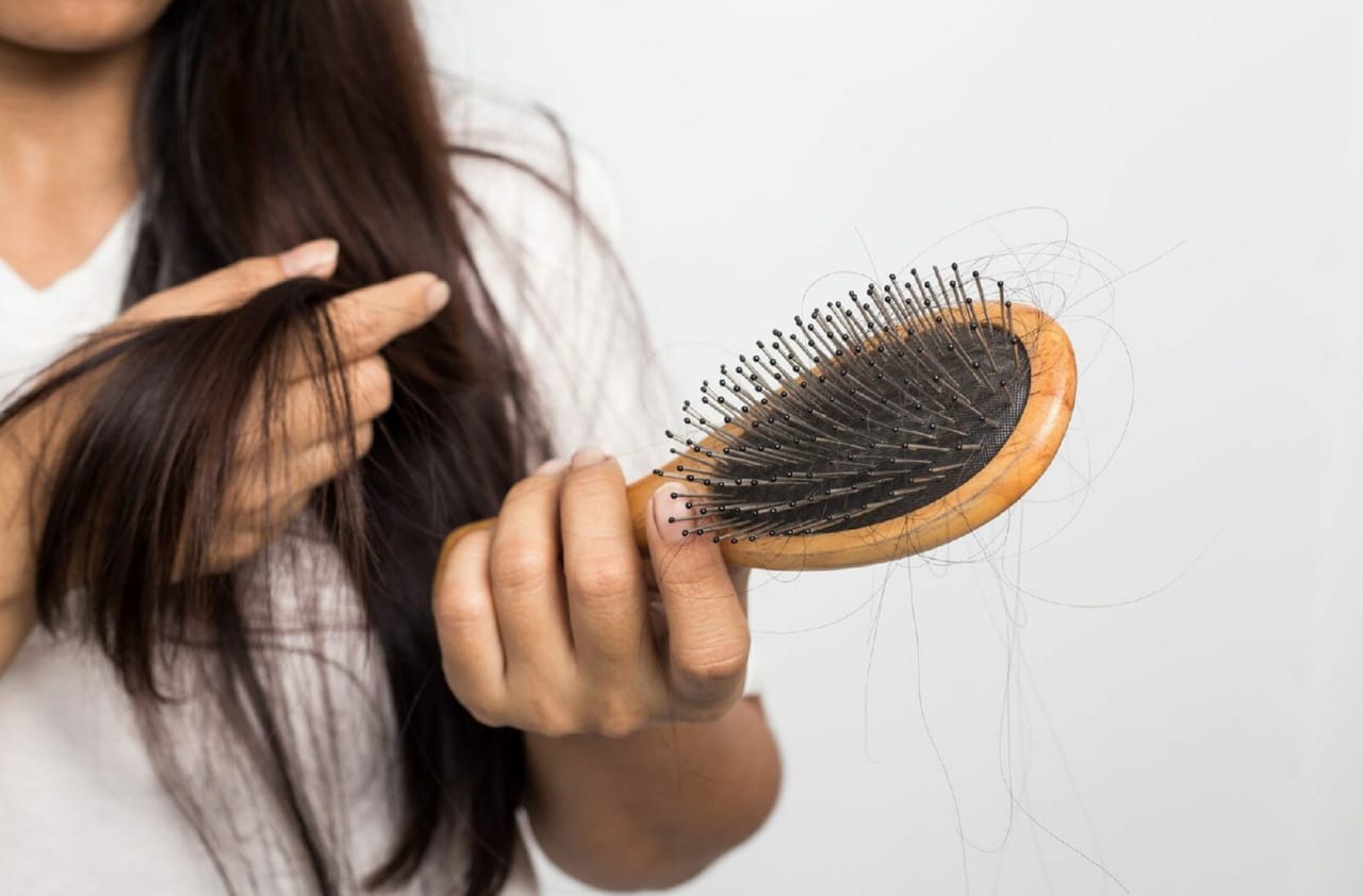 hair loss from stress