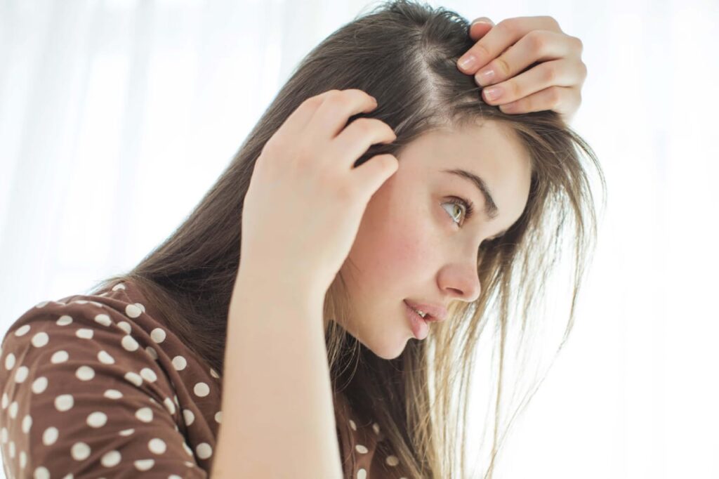 hair loss from stress