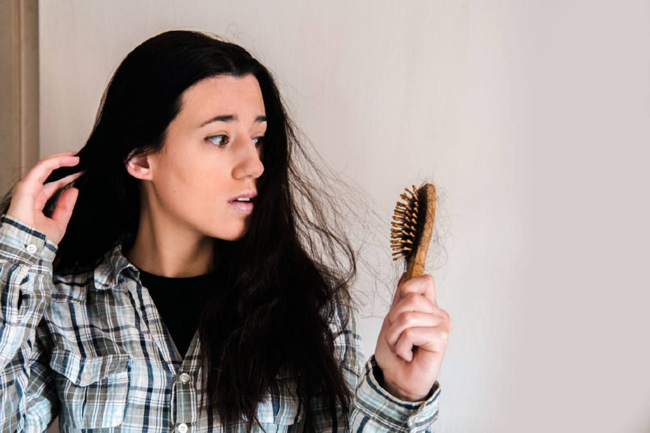 hair loss in teenage girl