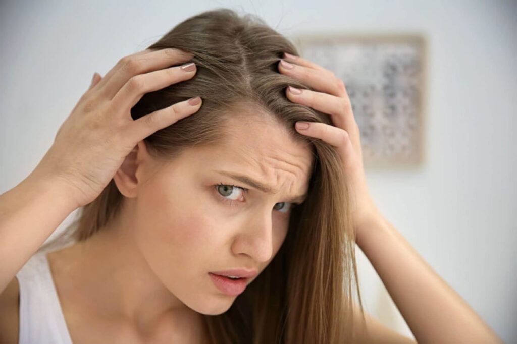 hair loss in teenage girl